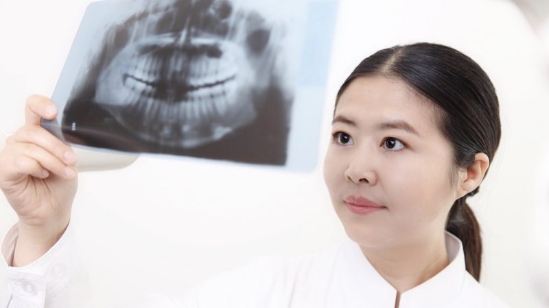 后牙修复，烤瓷牙与全瓷牙的抉择